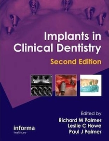 عکس Implants in Clinical Dentistry 2nd Edición