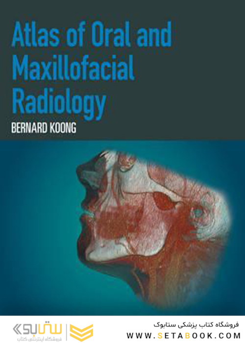 Atlas of Oral and Maxillofacial Radiology