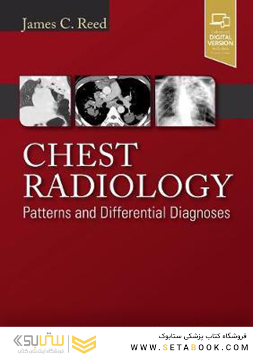 Chest Radiology : Patterns and Differential Diagnoses