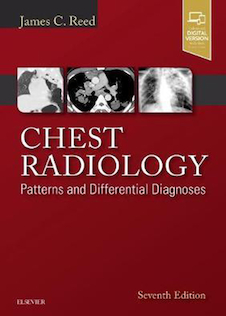 عکس Chest Radiology : Patterns and Differential Diagnoses