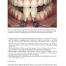 Practical Procedures in Aesthetic Dentistry