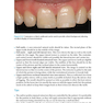 Practical Procedures in Aesthetic Dentistry