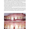 Practical Procedures in Aesthetic Dentistry