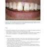 Practical Procedures in Aesthetic Dentistry