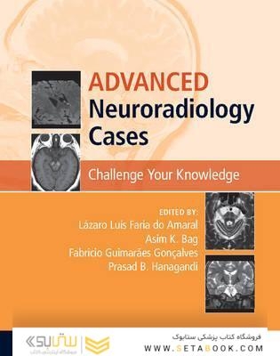 Advanced Neuroradiology Cases: Challenge Your Knowledge 1st Edición