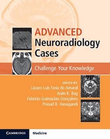 عکس Advanced Neuroradiology Cases: Challenge Your Knowledge 1st Edición