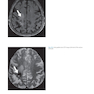 Advanced Neuroradiology Cases: Challenge Your Knowledge 1st Edición