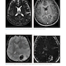 Advanced Neuroradiology Cases: Challenge Your Knowledge 1st Edición