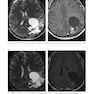 Advanced Neuroradiology Cases: Challenge Your Knowledge 1st Edición