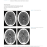 Advanced Neuroradiology Cases: Challenge Your Knowledge 1st Edición