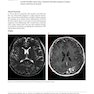 Advanced Neuroradiology Cases: Challenge Your Knowledge 1st Edición