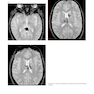 Advanced Neuroradiology Cases: Challenge Your Knowledge 1st Edición