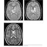 Advanced Neuroradiology Cases: Challenge Your Knowledge 1st Edición