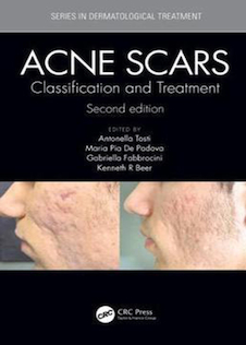 عکس Acne Scars: Classification and Treatment, 2nd Edition