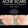 Acne Scars: Classification and Treatment, 2nd Edition