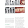 Zero Bone Loss Concepts 1st Edition 2019
