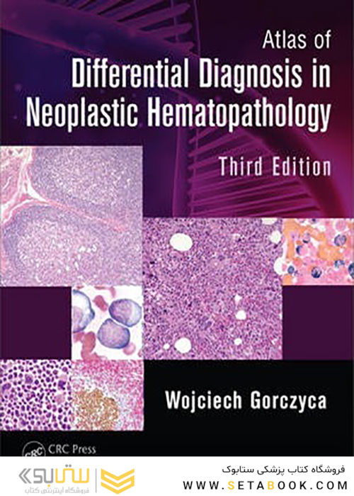 Atlas of Differential Diagnosis in Neoplastic Hematopathology, 3rd Edition2014 اطلس تشخیص افتراقی در خون شناسی نئوپلاستیک