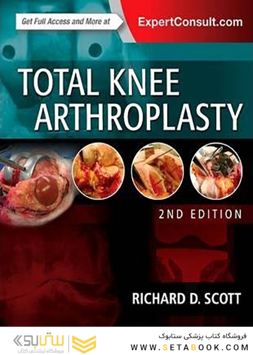 Total Knee Arthroplasty, 2nd Edition2014 آرتروپلاستی کامل زانو