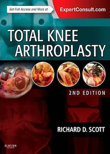 عکس Total Knee Arthroplasty, 2nd Edition2014 آرتروپلاستی کامل زانو