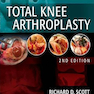 Total Knee Arthroplasty, 2nd Edition2014 آرتروپلاستی کامل زانو