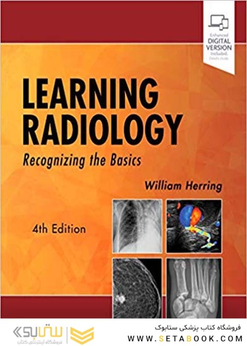 Learning Radiology: Recognizing the Basics 4th Edition