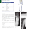 Bontrager’s Textbook of Radiographic Positioning and Related Anatomy, 9th Edition2017