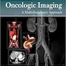 Oncologic Imaging: A Multidisciplinary Approach: Expert Consult - Online and Print