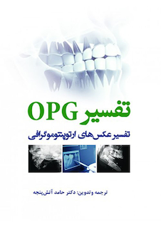 عکس تفسیر OPG تفسیر عکس های ارتوپنتوموگرافی