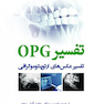 تفسیر OPG تفسیر عکس های ارتوپنتوموگرافی