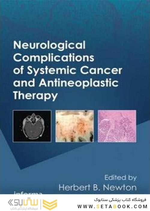 Neurological Complications of Systemic Cancer and Antineoplastic Therapy2010
