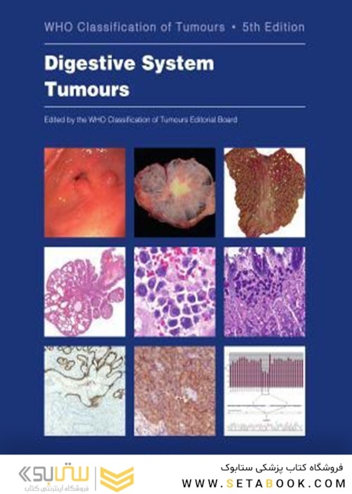 WHO Classification of Tumours. Digestive System Tumours : WHO Classification of Tumours