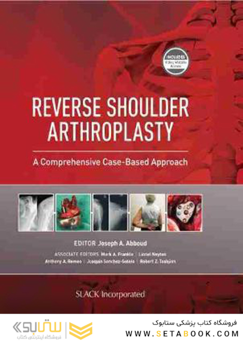 Reverse Shoulder Arthroplasty : A Comprehensive Case-Based Approach