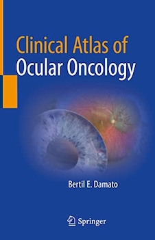 عکس Clinical Atlas of Ocular Oncology