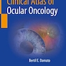 Clinical Atlas of Ocular Oncology