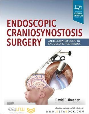 Endoscopic Craniosynostosis Surgery : An Illustrated Guide to Endoscopic Techniques
