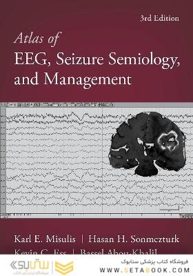 Atlas of EEG, Seizure Semiology, and Management 3rd Edición