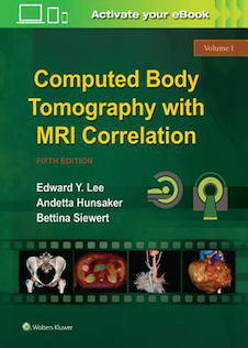 عکس Computed Body Tomography with MRI Correlation