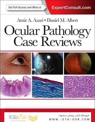 Ocular Pathology Case Reviews 1st Edition2014