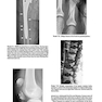 2013Musculoskeletal Imaging: The Requisites (Requisites in Radiology) 4th Edition