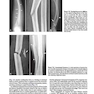 2013Musculoskeletal Imaging: The Requisites (Requisites in Radiology) 4th Edition