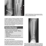 2013Musculoskeletal Imaging: The Requisites (Requisites in Radiology) 4th Edition