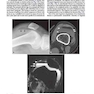 2013Musculoskeletal Imaging: The Requisites (Requisites in Radiology) 4th Edition