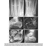 2013Musculoskeletal Imaging: The Requisites (Requisites in Radiology) 4th Edition