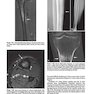 2013Musculoskeletal Imaging: The Requisites (Requisites in Radiology) 4th Edition