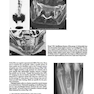 2013Musculoskeletal Imaging: The Requisites (Requisites in Radiology) 4th Edition