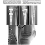 2013Musculoskeletal Imaging: The Requisites (Requisites in Radiology) 4th Edition