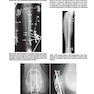 2013Musculoskeletal Imaging: The Requisites (Requisites in Radiology) 4th Edition