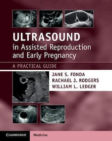 عکس Ultrasound in Assisted Reproduction and Early Pregnancy: A Practical Guide 1st Edición