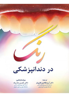 عکس رنگ در دندانپزشکی
