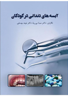 عکس آبسه های دندانی در کودکان